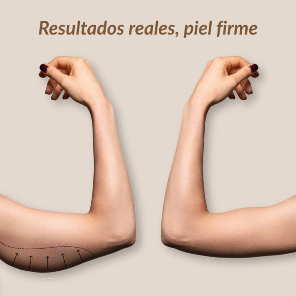 Gua Sha - Masajes Linfáticos