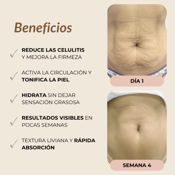Aceite Corporal Reafirma, Tensa e Hidrata la piel flácida
